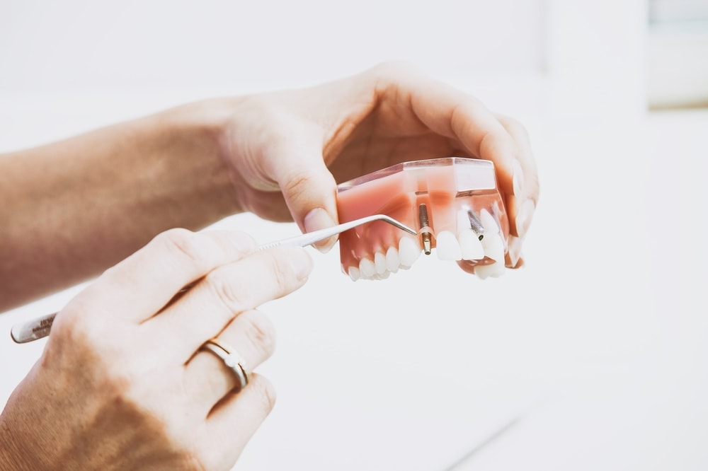 New Dentures New Dentures
